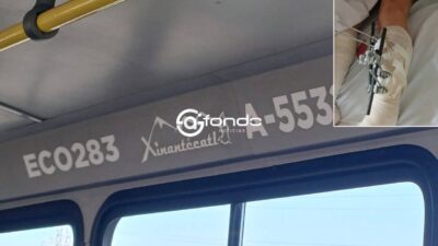 INJUSTICIA. Catalina sufrió una fractura en su pierna por culpa del chofer de un camión de pasajeros