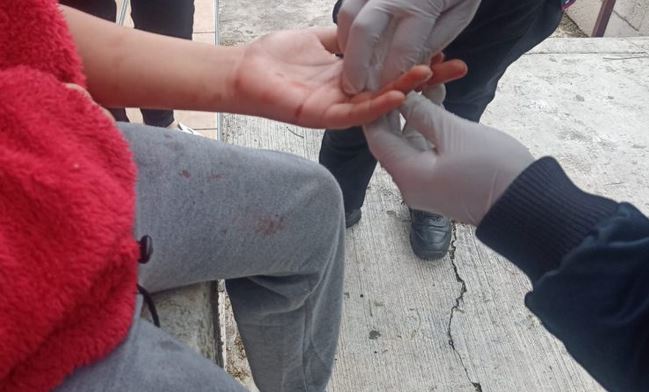 SALVAJE: Sujeto de 23 años apuñala a su hermano de 11 porque se comía su hamburguesa