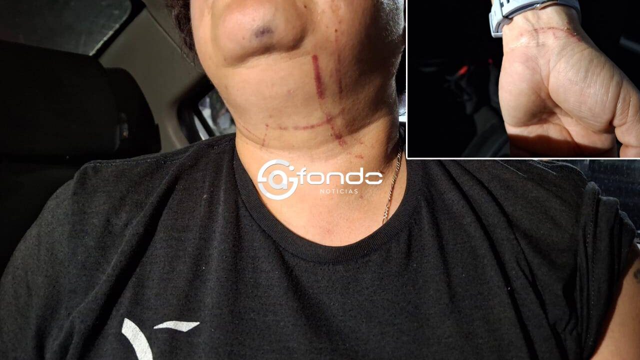 VIDEO. Pareja enloquece y agrede a sus propios familiares; muerden a un primo y golpean a una niña