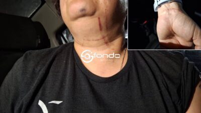 VIDEO. Pareja enloquece y agrede a sus propios familiares; muerden a un primo y golpean a una niña