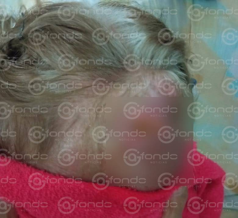 DESDICHADO. Sujeto abandona a su mamá de 80 años con cáncer severo en Edomex