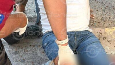 IMPRUDENTE: Motociclista en sentido contrario termina con las piernas rotas