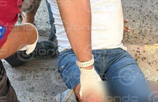 IMPRUDENTE: Motociclista en sentido contrario termina con las piernas rotas