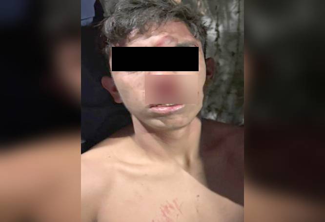 DELINCUENTE. Milton tiene 15 años y ya es un peligroso criminal; vecinos lo apalean después de robar una moto