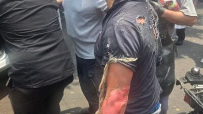 ESTALLIDO: Padre e hijo llevaban un tanque de gas en el auto y les explotó