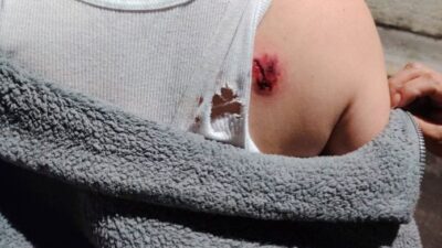 VIDEO. ‘Ya que lo mate’; dueños de pitbull presencian cómo mataba a ‘Duque’ y mordía a la dueña