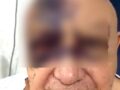 VIDEO: Luis de Alba ‘El Pirruris’ queda irreconocible del rostro tras accidente