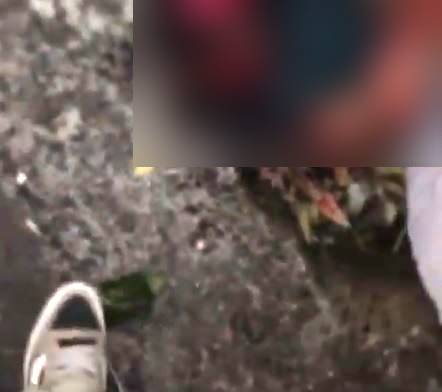 VIDEO: ‘¿Dónde estoy?’; motociclista sin casco termina sin piel en la cabeza