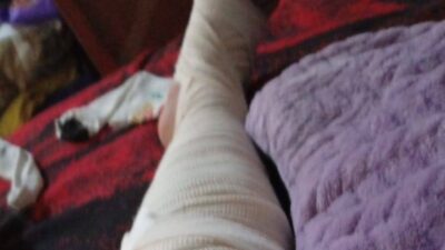 DENUNCIA. Mujer lleva dos años incapacitada por negligencia médica y sin pensión por corrupción del IMSS