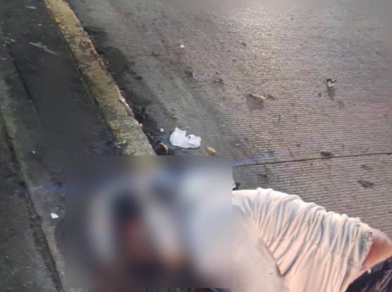 CAÍDO: La noche llegó con la muerte para un motociclista que terminó contra un muro